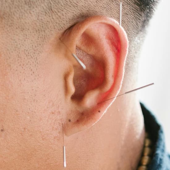 Øreakupunktur Øreakupunktur